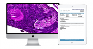 Dermapathology Report onscreen of the ipad and desktop